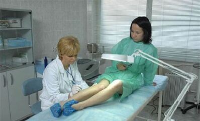 wie man Krampfadern in den Beinen behandelt